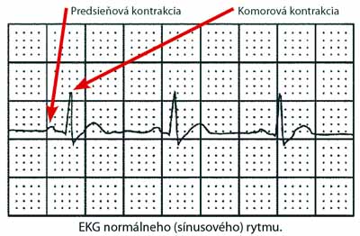 Normálne EKG